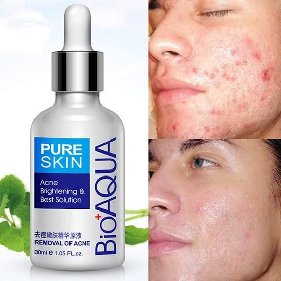 Serum Control de Acné PURE SKIN - Bioaqua